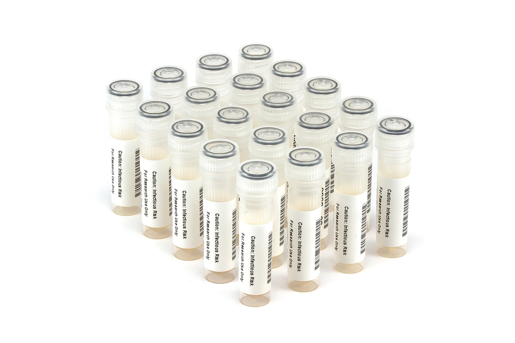 HBV9099 HBV Seroconversion Panel Donor n. 75255 (20x 1 ml)