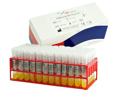 P0318-04 ViraQ HIV-2 Check 125