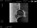 US-13 Infant Hip Sonography Training Phantom