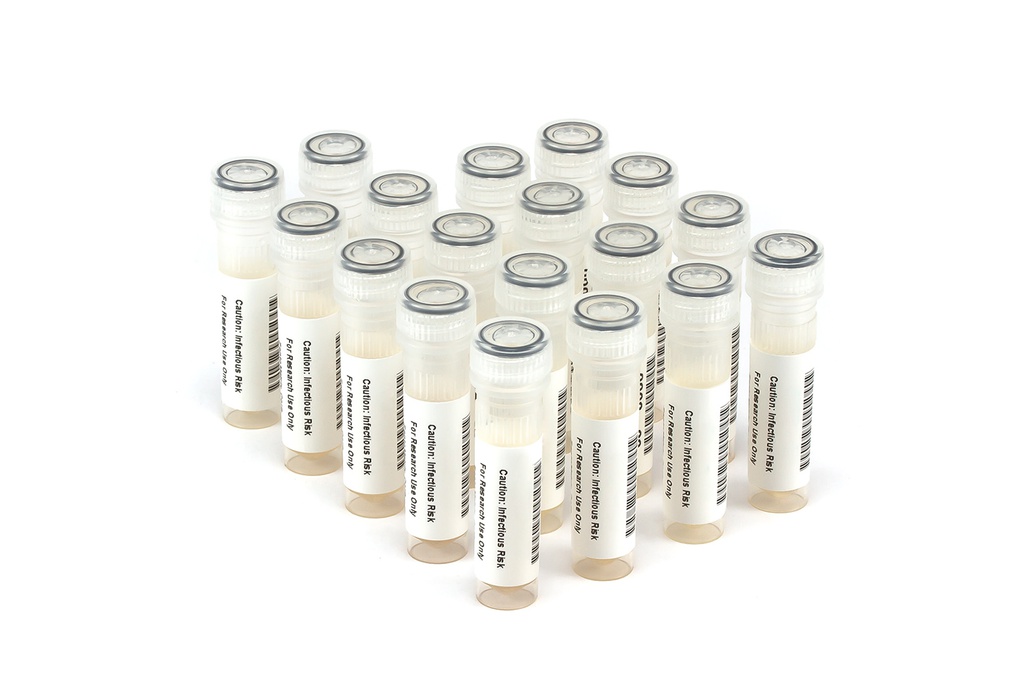 HBV9072 HBV Seroconversion Panel Donor n. 66481 (17x 1 ml)