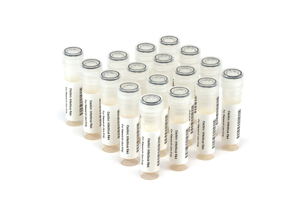 HIV9021 HIV Seroconversion Panel Donor n. 67485 (17x 1 ml)