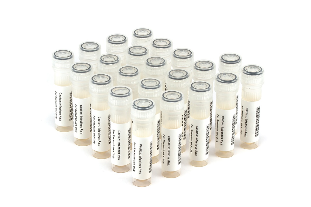 HIV9023 HIV Seroconversion Panel Donor n. 67706 (21x 1 ml)